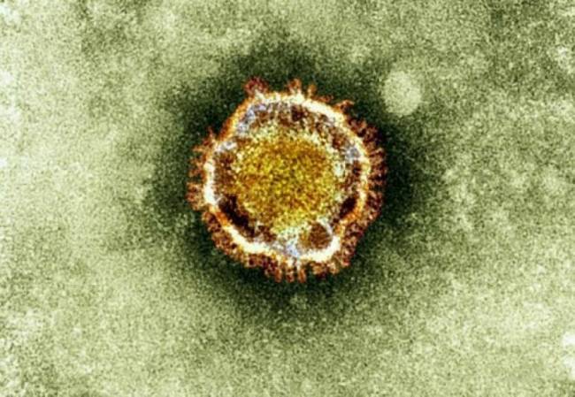 coronavirus